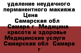 удаление неудачного перманентного макияжа › Цена ­ 1 500 - Самарская обл., Самара г. Медицина, красота и здоровье » Медицинские услуги   . Самарская обл.,Самара г.